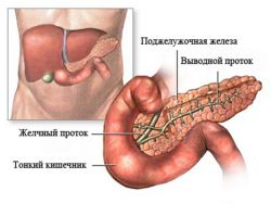 známky exacerbace chronické pankreatitidy