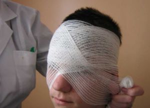 blindfold 3