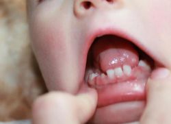 Zuby v dětských symptomech