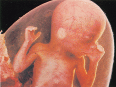 fetální močový měchýř