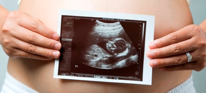 Fetalni vijek trajanja po tjednu - stol