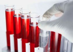 analiza biochemiczna szybkości fibrynogenu we krwi