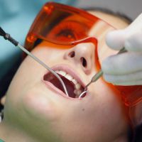 proces wypełniania zębów