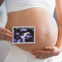 ultrazvuk v prvním trimestru těhotenství