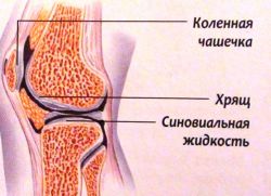 akumulacija tekućine u koljenastom zglobu