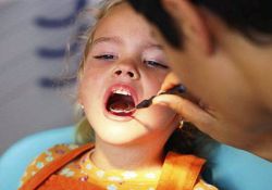 fluoridace zubů u dětí