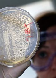 hemolitička E. coli u odraslih osoba