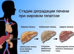 jetrne maščobne simptome jeter