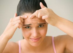 Kako se znebiti možganov na obrazu najstnika
