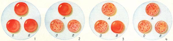 Как можно определить группу крови