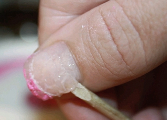 kako ukloniti produžene nokte kod kuće 4