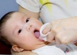 Candida в млечница при новородени