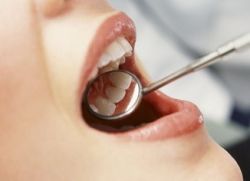Чем можно дома отбелить зубы