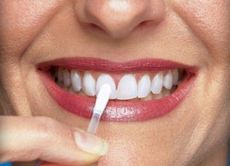 peroxid vodíku pro bělení zubů