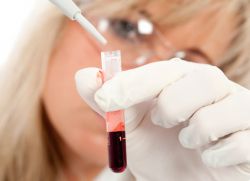 vysoký obsah nezralých granulocytů v krvi