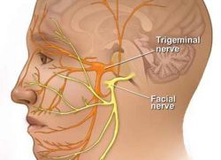 признаци на възпаление на тригеминалния нерв