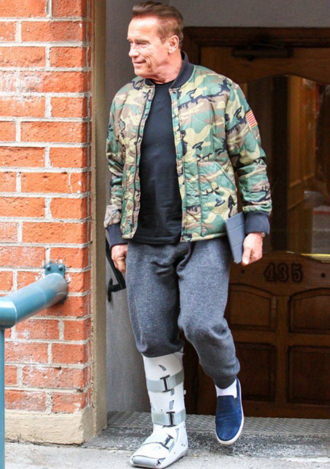 Арнольд Шварценеггер вынужден носить гипс и медицинский ботинок