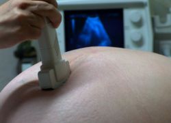 što je štetno za ultrazvučni fetus