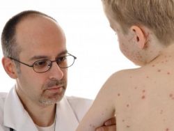 je možné koupat dítě s neštovicemi