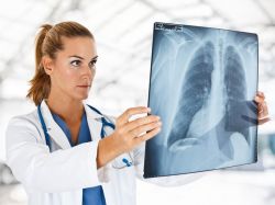 Czy w czasie ciąży można wykonać zdjęcie rentgenowskie?