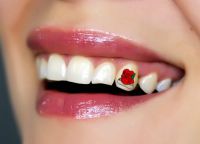 украси за зубе 8