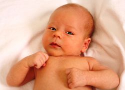 tortikollija pri otroku 3 meseci simptomi