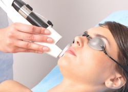 ласерска козметологија лица