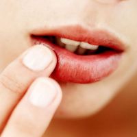 симптоми рак на устните