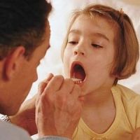 Възможно ли е децата да имат лизообакт