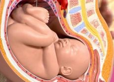 niska pozicija fetusa tijekom trudnoće