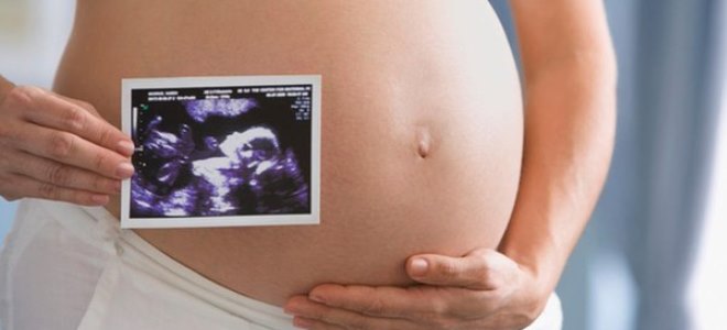 niska placentacija tijekom trudnoće 21 tjedan
