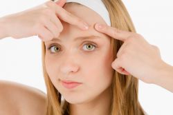 leczenie trądziku na twarz u nastolatków