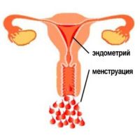 proč dochází k poruše menstruačního cyklu