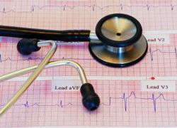 příznaky a účinky infarktu myokardu