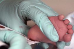 pregledovanje novorojenčkov