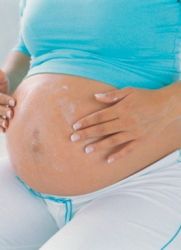 maści z rozstępów w czasie ciąży