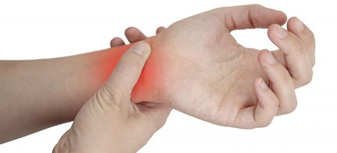 Artritis: smanjite bol u zglobovima