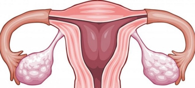 vaječníků u žen