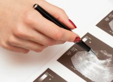 rak jajnika na ultrazvuku