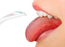kako ukloniti papiloma na jeziku