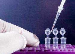 Otkrivanje PCR infekcije