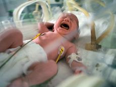perinatalna smrtnost