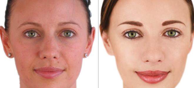 makijaż permanentny powieki zdjęcia przed i po 2