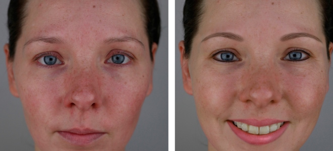 makijaż permanentny wiek zdjęcie przed i po 3