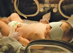 фототерапијска лампа за новорођенчад