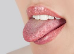 pimple na zdravljenje z jezikom