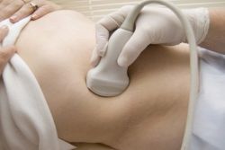 аборт с извънматочна бременност