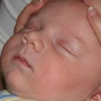 deformacija djeteta lubanje