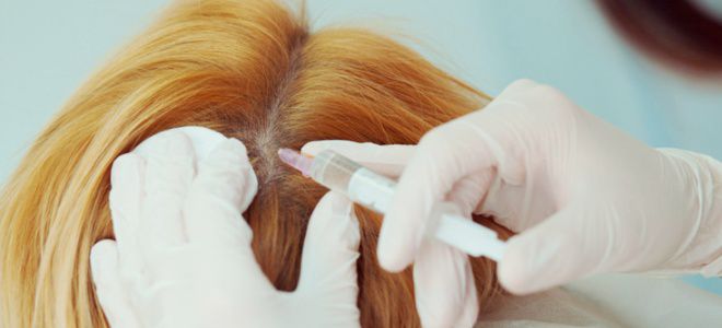 Как делается плазмолифтинг волос инъекция