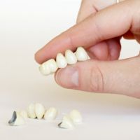 пластмасови коронки на дъвчещи зъби